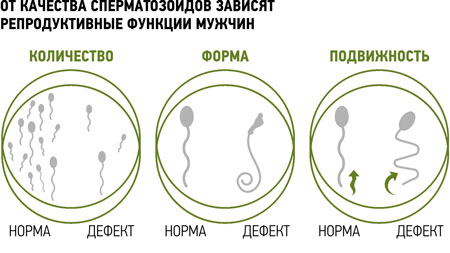 здоровые сперматозоиды